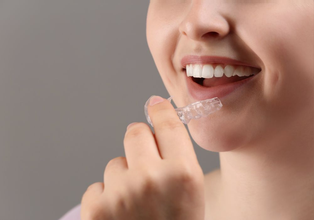 Cabinet dentaire IDRO - Sene - Morbihan - Orthodontie invisible