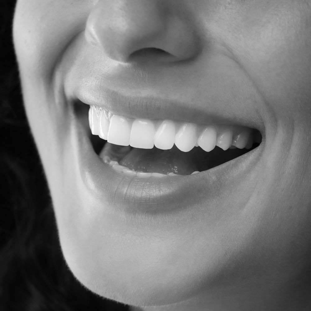 Cabinet dentaire IDRO - Sene - Morbihan - Dentisterie esthétique