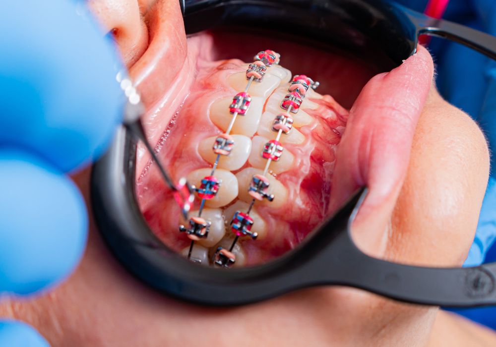 Cabinet dentaire IDRO - Sene - Morbihan - Orthodontie